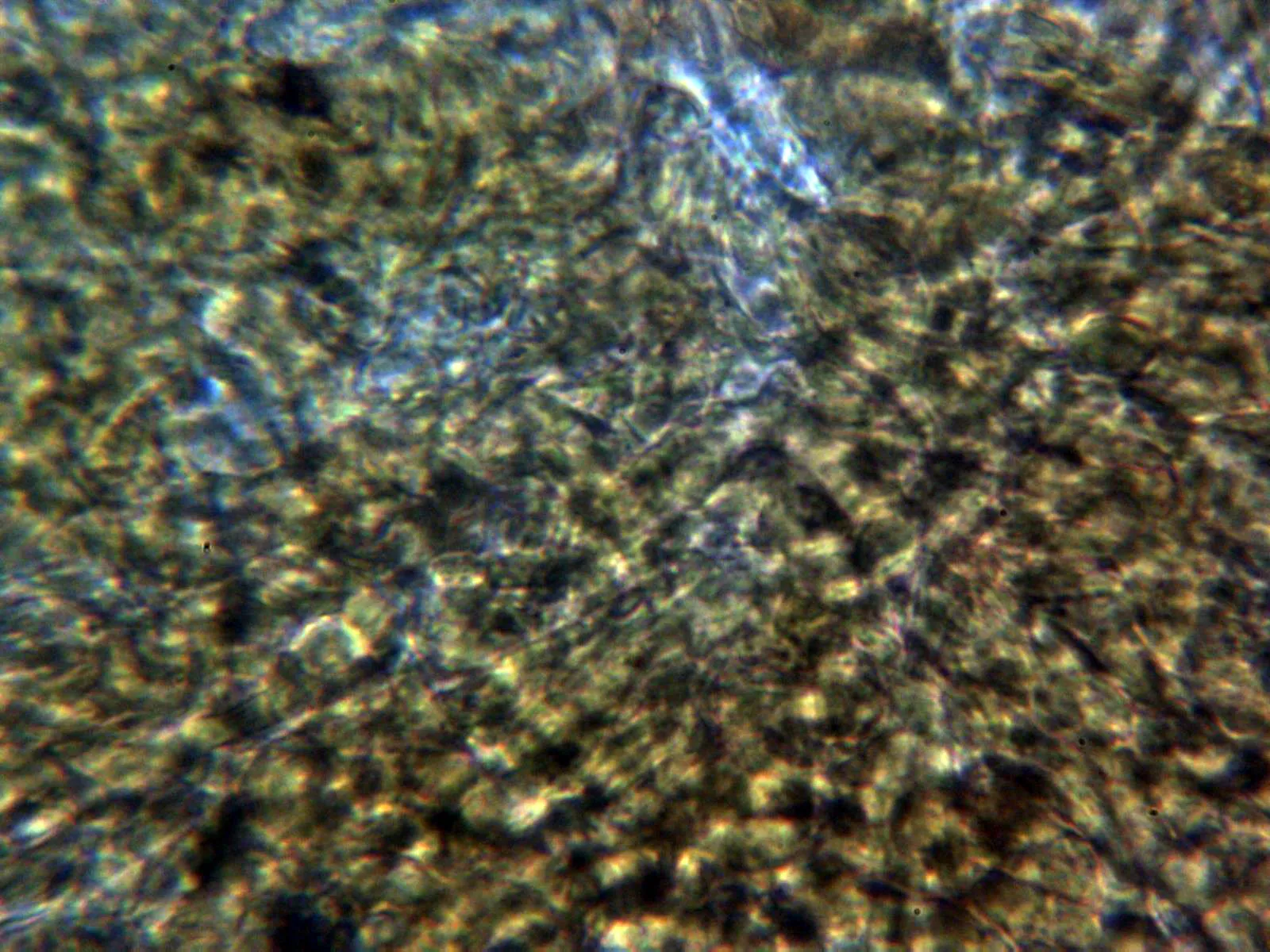 10 - Exoperidio parte externa